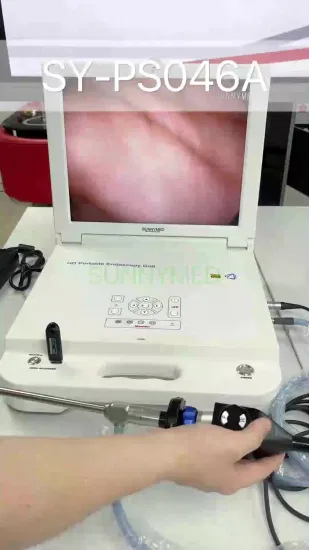 Câmera endoscópica de artroscopia com sistema de endoscópio totalmente HD